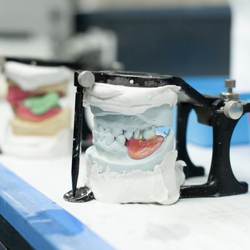 Dentures in the process of being crafted at a lab