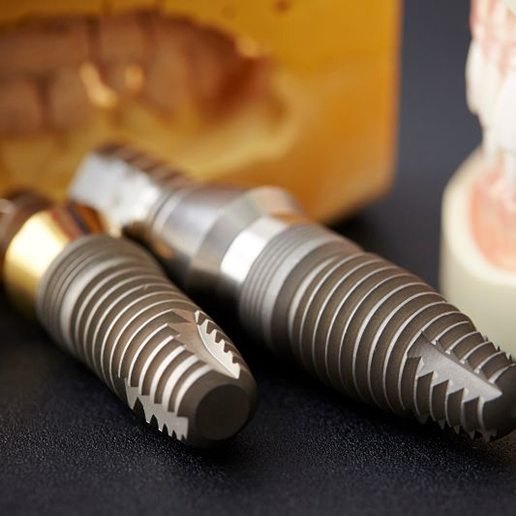 Close-up of enlarged dental implants next to tooth model