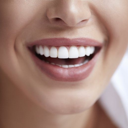 Close up of woman with straight white teeth smiling