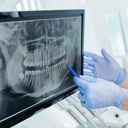 Dentist pointing to x rays of a patient