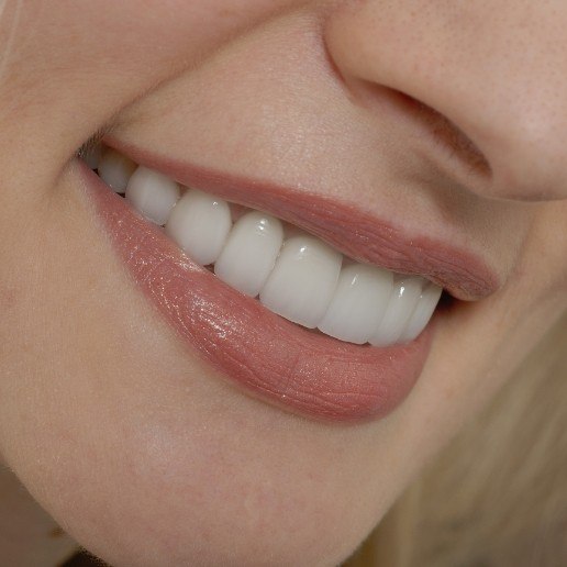 Close up of blonde woman smiling with straight white teeth